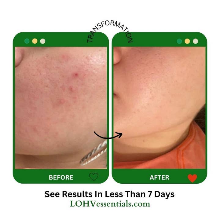 LOHV ESSENTIALS - Wholesale Facial Cleanser - PREMIUM 100% VEGAN CLEANSE THE DAY AWAY Face Cleanser with Hyaluronic Acid + Lactic Acid + Glycolic Acid Face Cleanser4