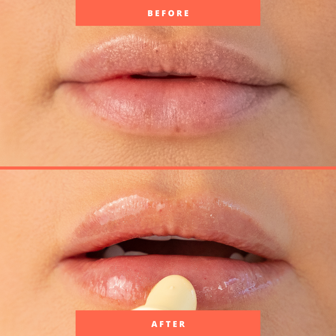 SOLSPELL - Wholesale Lip Balm - Vitamin D Lip Oil4