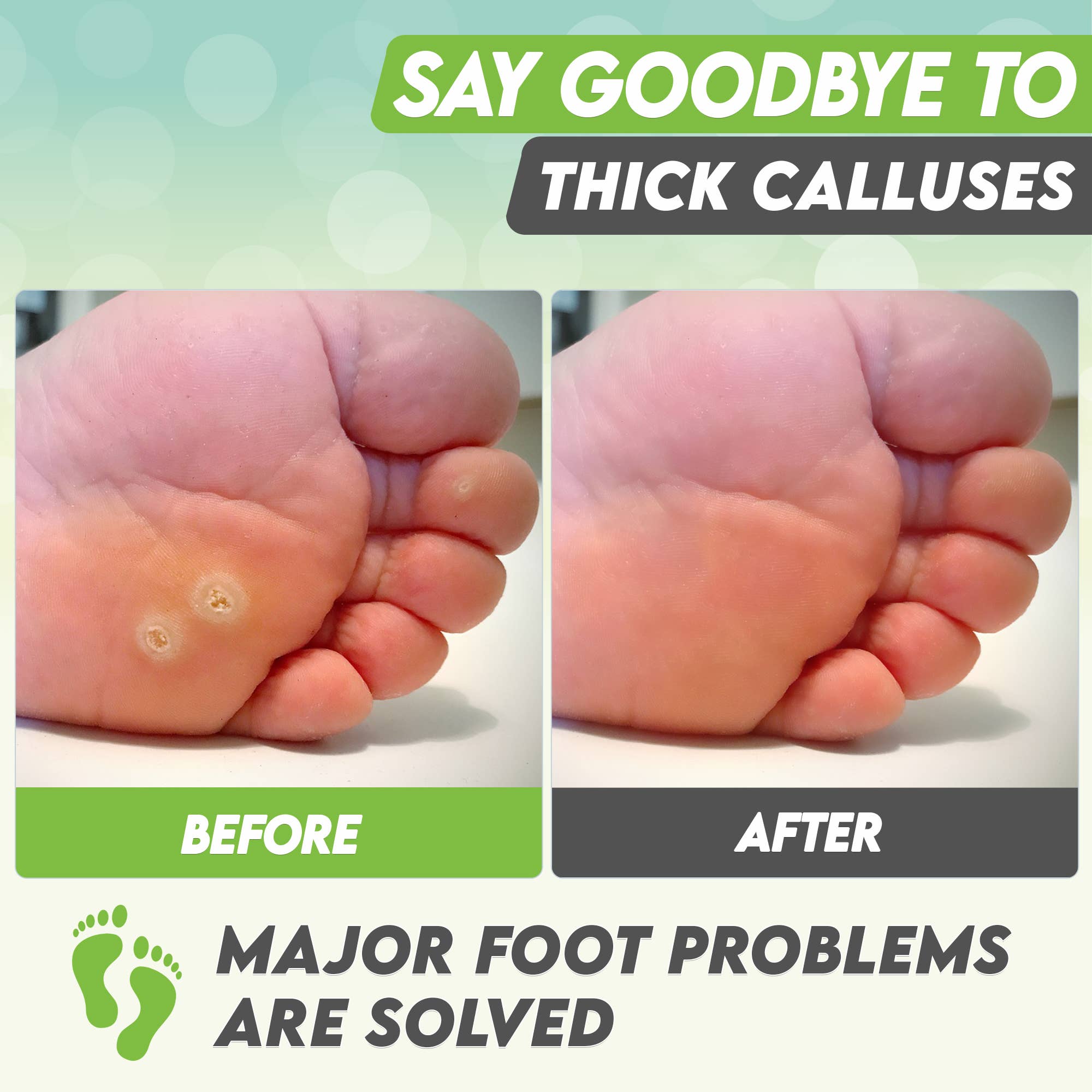 Karma Organic spa – wholesale Fotmask – Foot Peel Mask 2 Pack —Grönt te Fotmask skal 100% ekologisk6