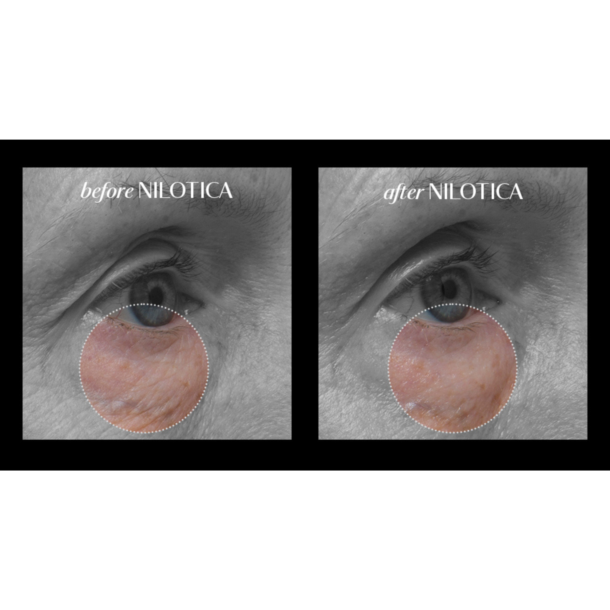 LXMI - Wholesale Healing Salve/Balm/Cream - Pure Nilotica Melt Barrier Balm4