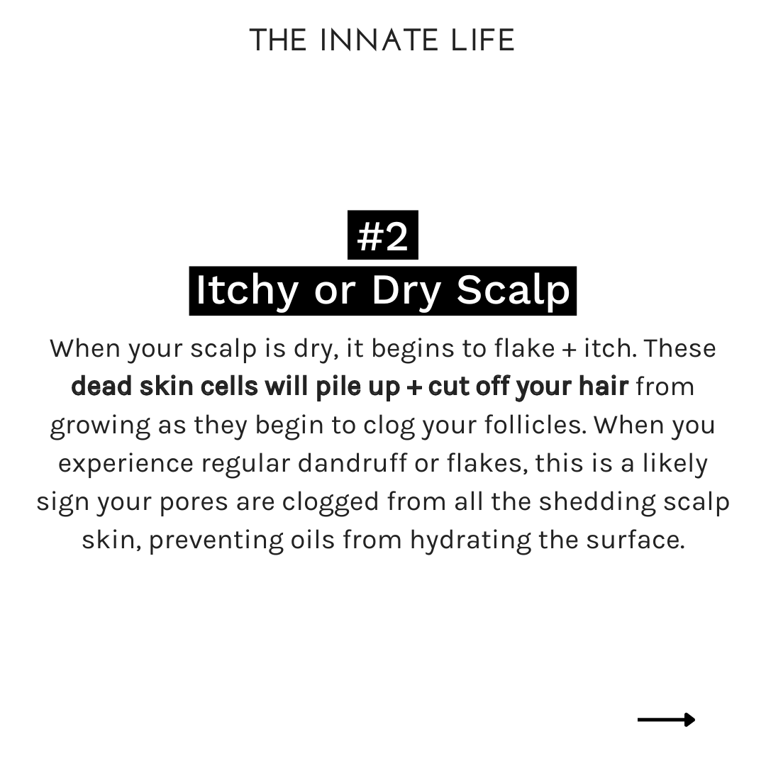 The Innate Life - Wholesale Scalp/Hair Treatment - CHARCOAL SCALP DETOX7