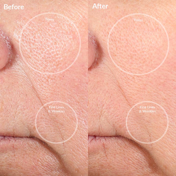 PMD Beauty - US - Wholesale Electronic Skincare Device - PMD Personal Microderm Pro