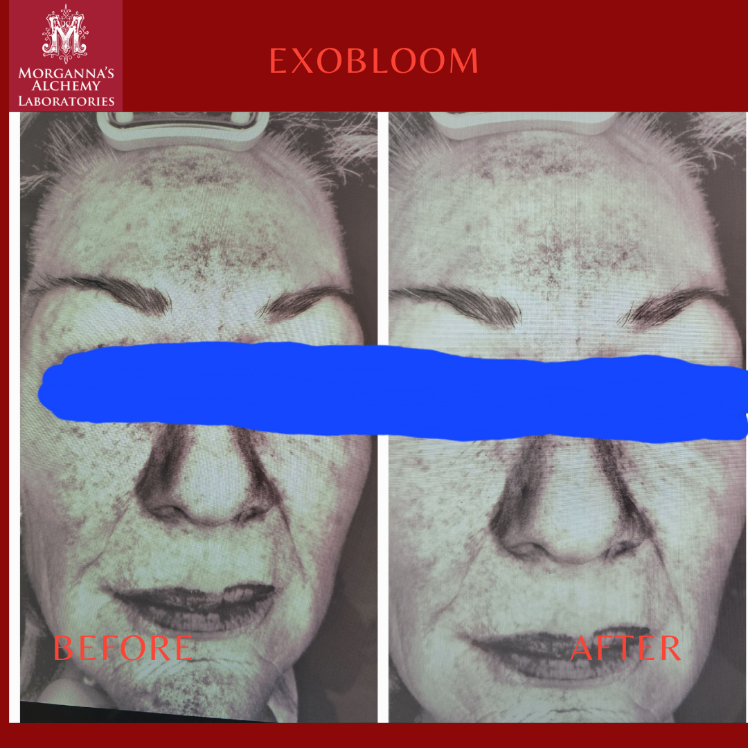 Morganna's Alchemy - Wholesale Anti-Aging Moisturizer - Morganna’s ExoBloom™ – Advanced Repair Gel with Plant Exosom1