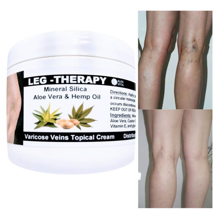 AlkaVita - Wholesale Healing Salve/Balm/Cream - Varicose Vein Leg Therapy Relief Cream Silica Hemp Seed Oil2