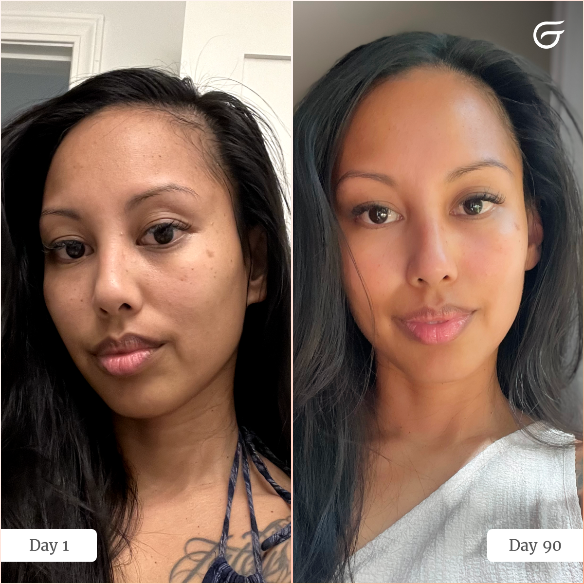 Groomie Hers - Wholesale Skincare Face Mask - GlowUp™ LED Light Therapy Face Mask6