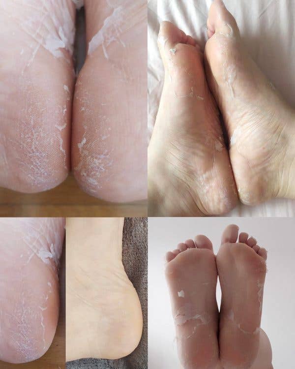 Iroha Nature - Wholesale Foot Mask - Socks Treatment For Feet | Exfoliating | Lavander1