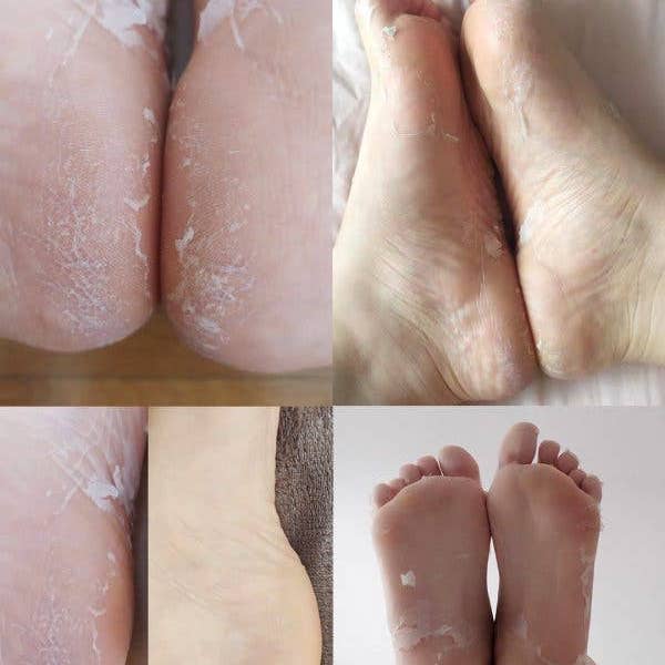 Iroha Nature - Wholesale Foot Mask - Socks Treatment For Feet | Exfoliating | Lavander1