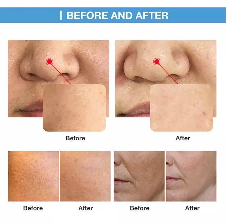 Cavitation Machines - Wholesale Electronic Skincare Device - Shape Tactics O+ Skin Care Oxygen CO2 & RF Beauty System9