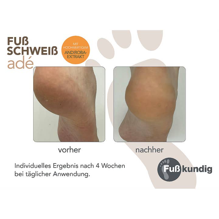 Fußkundig – Großhandel Fußcreme – Fußschweiss Adé Pflegeschaum 150ml