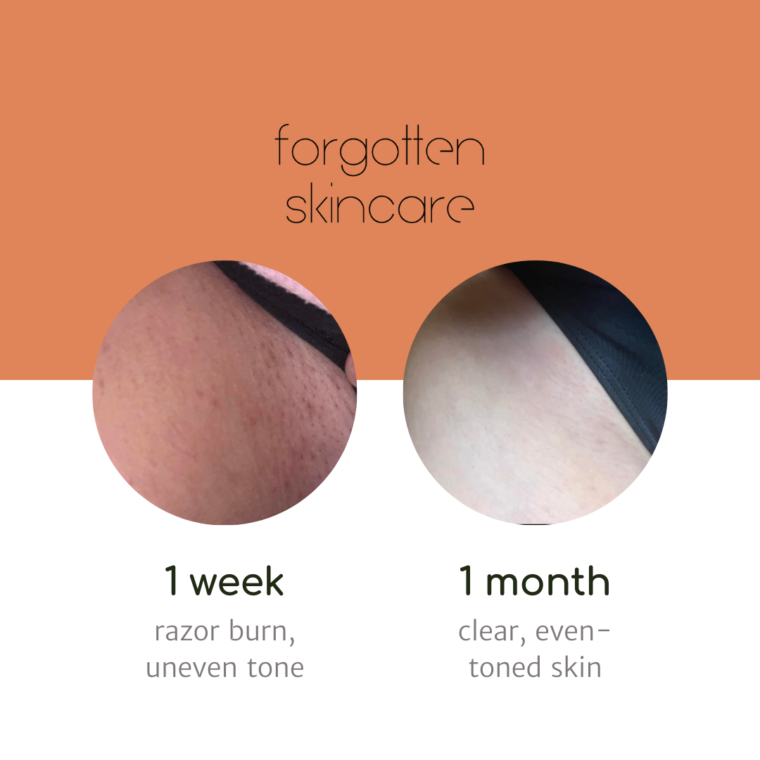 Forgotten Skincare - Wholesale Facial Serum/Concentrate - The Down Low Inner Thigh Serum3