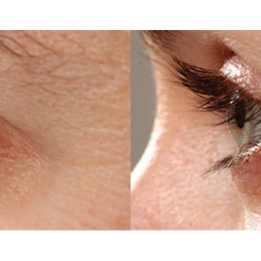 RapidLash - Vente Sérums cils/sourcils - Sérum améliorant les cils RapidLash6