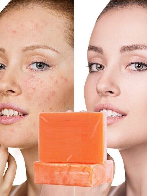 Hudlysende og blegende Kojic Acid Soap - 4x135g barer for engroshandel hos VeriDepot