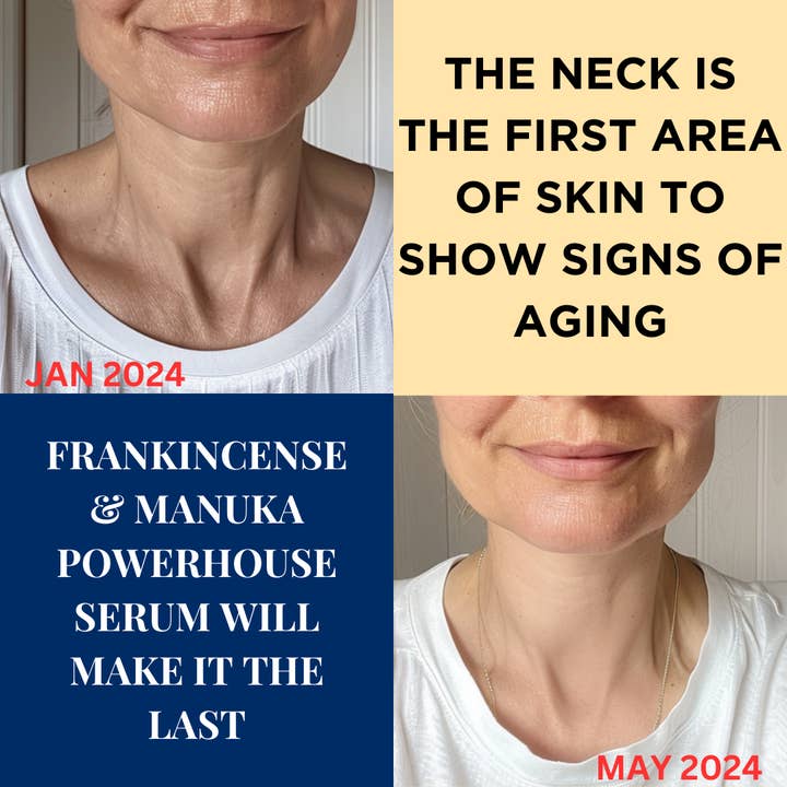 BESQUE - Venta al por mayor Sérum facial - Sérum facial reafirmante y rejuvenecedor5