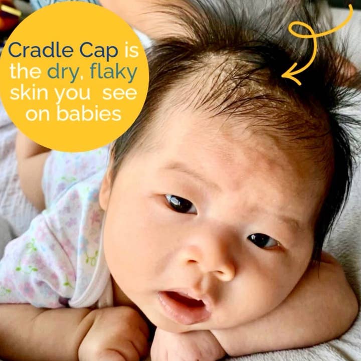 Happy Cappy - Wholesale Bath & Body Set - Baby - Happy Cappy 4 Product Bundle, Manage Cradle Cap and Dry Skin3