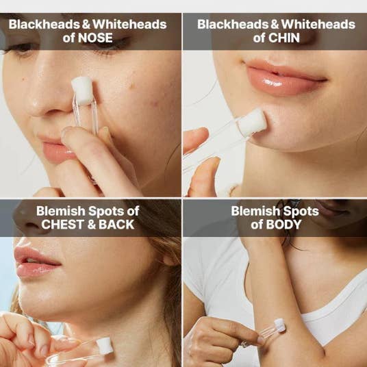 Best Beauty Group - Wholesale Facial Serum/Concentrate - COSRX AHA 2 BHA 2 Blemish Treatment Cotton Balls Serum7