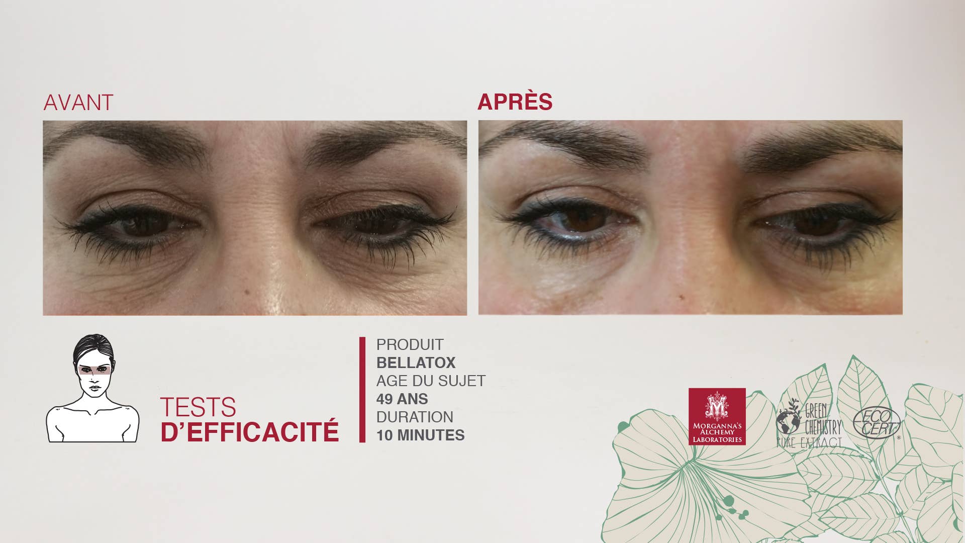 Morganna's Alchemy - Wholesale Anti-Aging Moisturizer - Morganna Bellatox with Paracress6