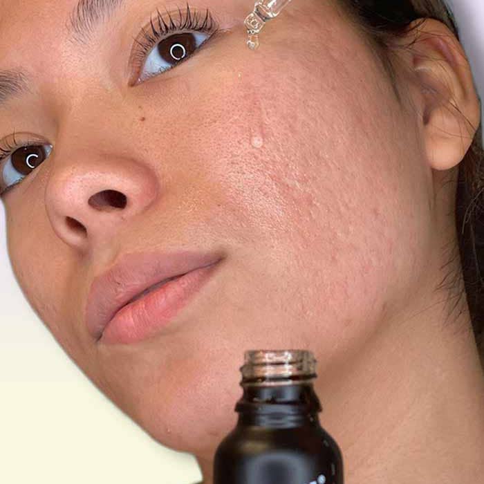 Banish - Wholesale Facial Serum/Concentrate - Banish Serum - Dark Spot Corrector Vitamin C Serum2