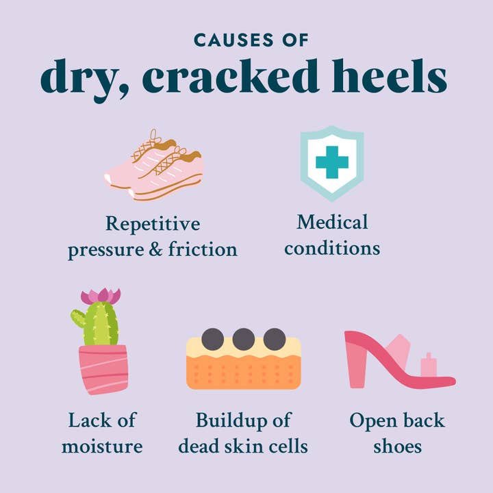 VOESH New York - Wholesale Foot Cream - Solemate Heel Repair Balm Retail Display Kit - Mint13