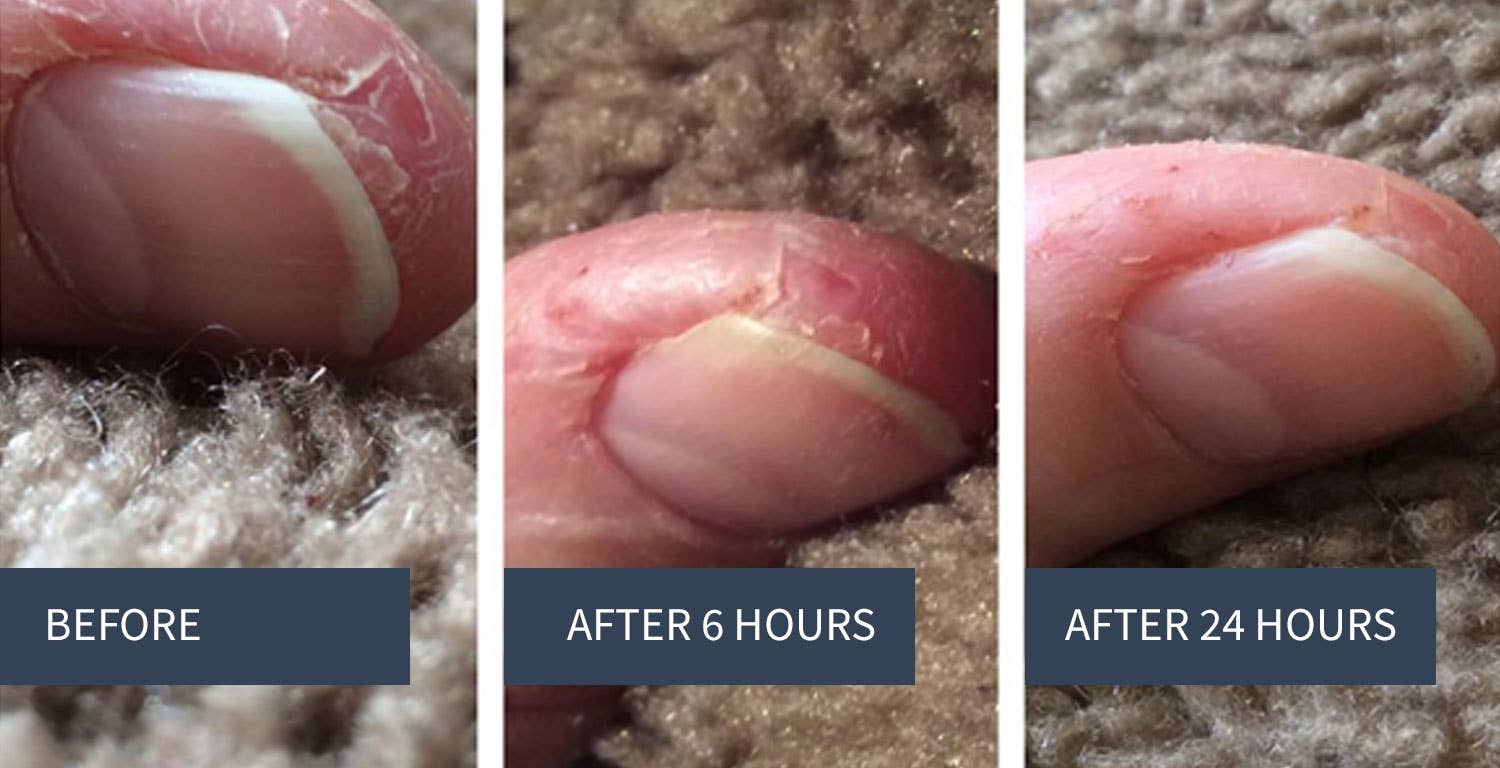 Honeoye Remedies - Wholesale Healing Salve/Balm/Cream - .8oz  Skin Balm- Tin5