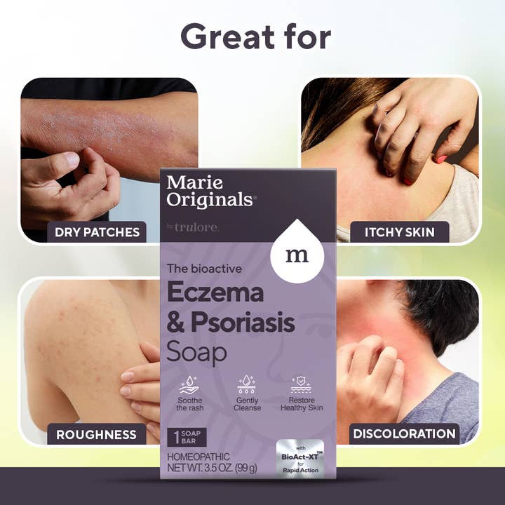 Marie's Original Formulas – wholesale Eczema treatment – Eczema / Psoriasis Relief Soap2