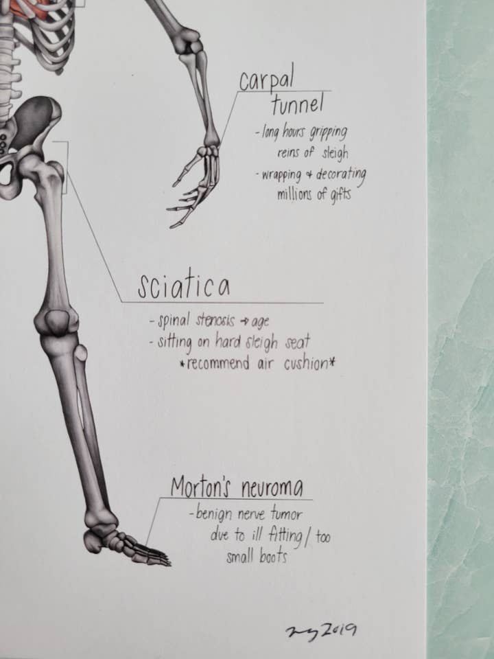 Santa's Differential Diagnosis for wholesale by Unstrung Studios