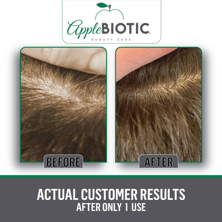Applebiotic - Wholesale Body Scrub/Exfoliant - Apple Cider Vinegar Probiotic Scalp and Body Scrub