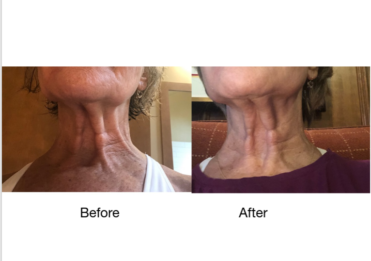 Addicted Beauty - Wholesale Skincare Face Mask - Neck & Jawline Mask and Serum 8