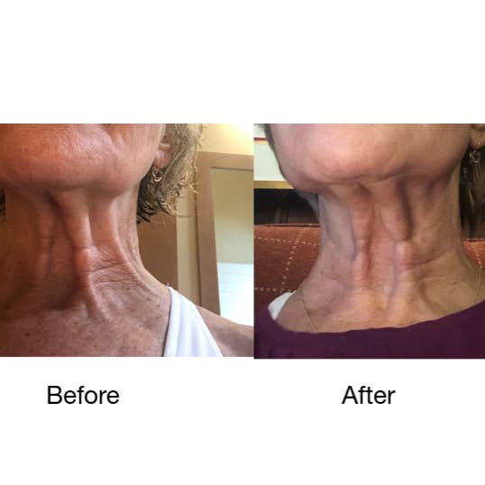 Addicted Beauty - Wholesale Skincare Face Mask - Neck & Jawline Mask and Serum 8