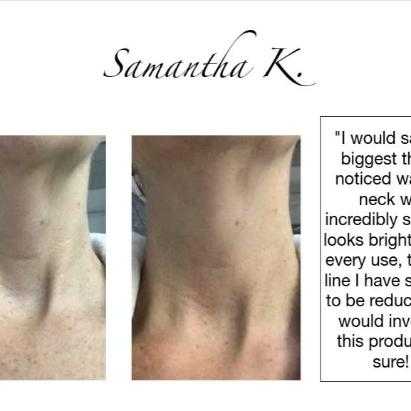 Addicted Beauty - Wholesale Skincare Face Mask - Neck & Jawline Mask and Serum 4
