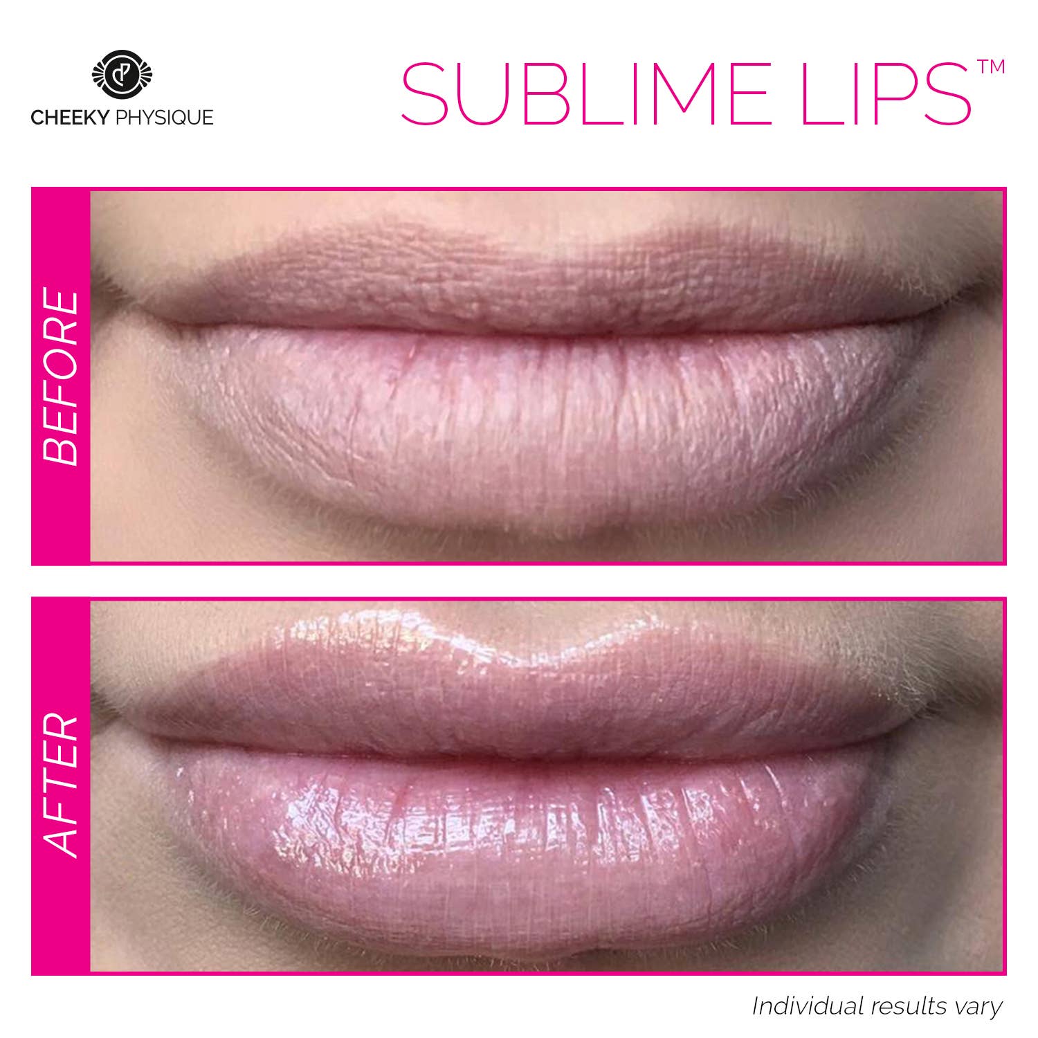 Cheeky Physique - Wholesale Lip Plumper - Sublime Lips - Manuka Honey Lip Plumper2