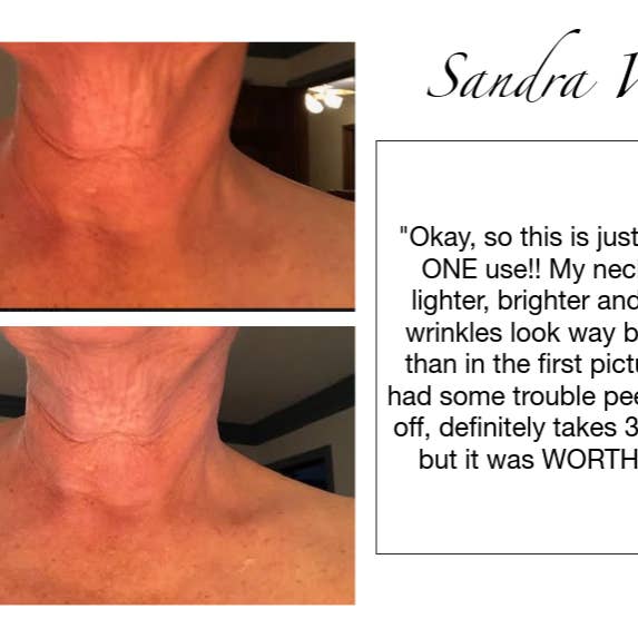 Addicted Beauty - Wholesale Skincare Face Mask - Neck & Jawline Mask and Serum 6