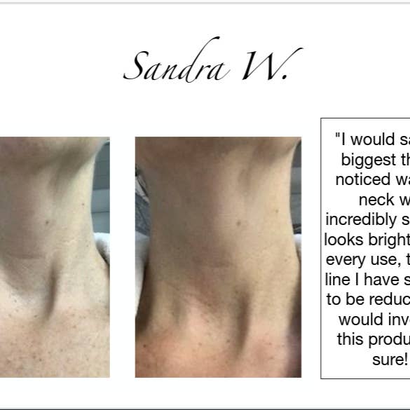 Addicted Beauty - Wholesale Skincare Face Mask - Neck & Jawline Mask and Serum 5